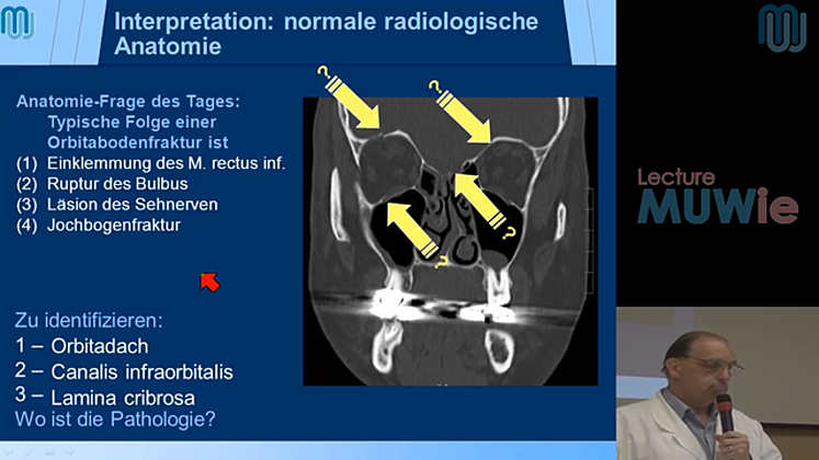 Still large fallkonferenz 2013 06 10 66jhg patient mit veilchenauge kainberger